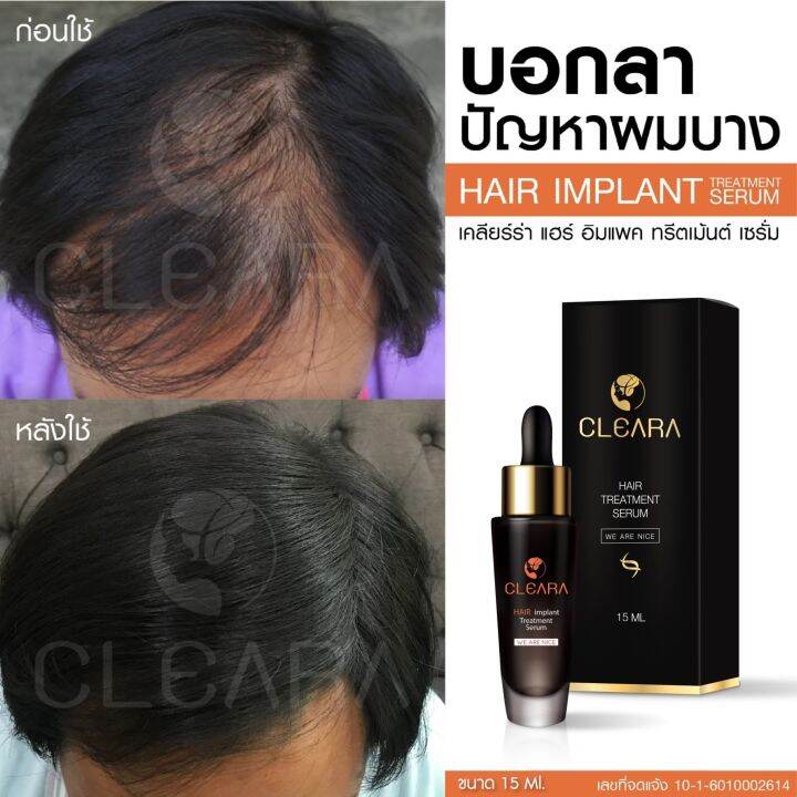 ส่งฟรี-cleara-เคลียร่า-เซรั่มปลูกผม-กระตุ้นรากผม-ผมหลุดร่วง-ผมดก-ดำ-ปลูกหนวด-ปลูกคิ้ว-ขนาด-15-ml