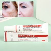 wei Freckle Cream Remove Skin Melasma Acne Spot Pigment Melanin Dark Spots Whitening ie