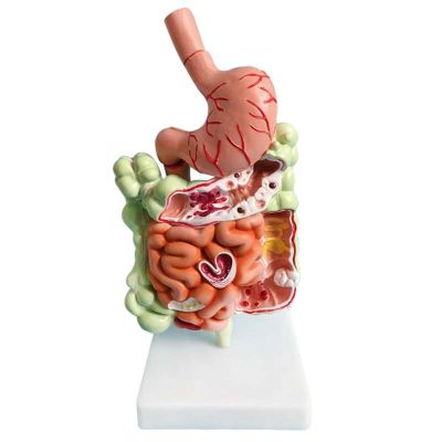 Human Digestive System Model Stomach Anatomy Large Intestine Cecum Rectum Duodenum Human Internal Organs Structure Model