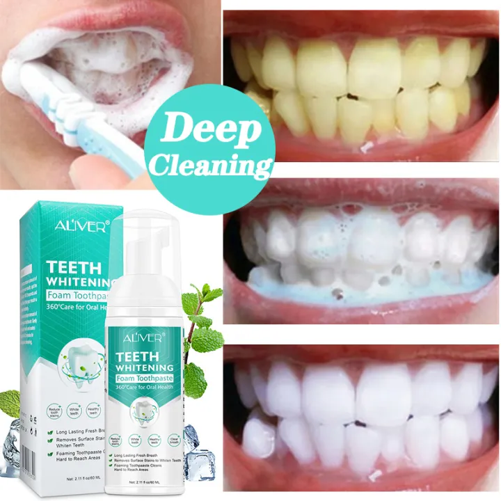 【Local delivery】 ALIVER Cleaning Teeth Whitening Mousse Foam Toothpaste