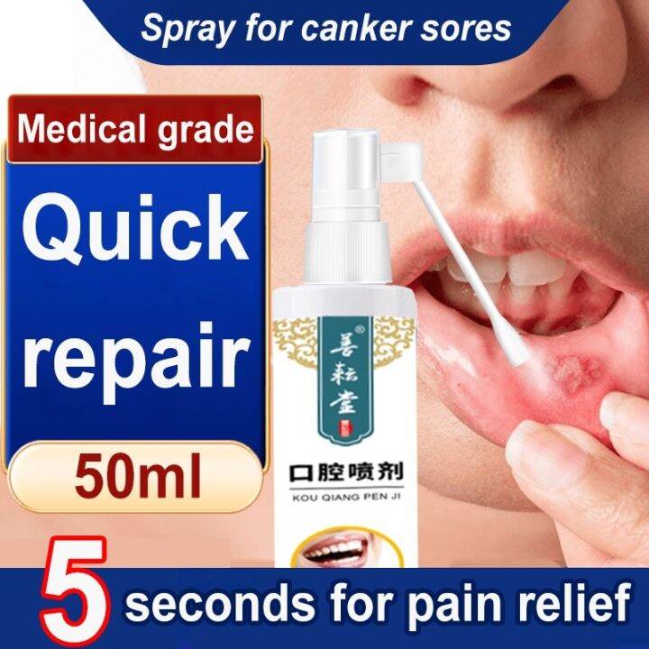 Canker mouth sore solution treatment 50ml mouth sore solution mouth
