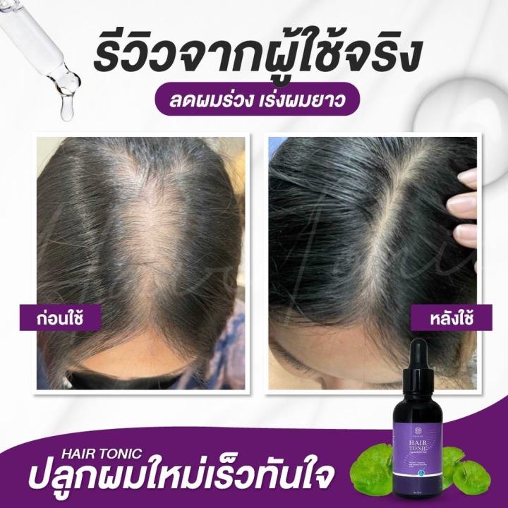 ส่งฟรี-chaba-ชบาโทนิค-ปลูกผม-ป้องกันผมร่วง