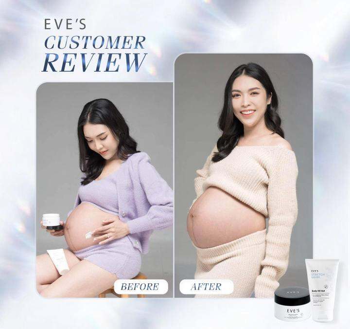 ส่งฟรี-ส่งไว-พร้อมส่ง-eves-บูสเตอร์อีฟส์-อีฟส์ออยล์-มาร์คบำรุงผิว-ลดรอยแตกลาย-eves-booster-white-body-cream-ครีมบำรุงผิว-สูตรเข้มข้น