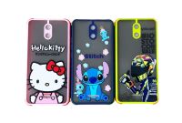 เคสสำหรับมือถือรุ่น Wiko Sunny5 เป็น Tpu ขอบสีนิ่ม ไม่ทำให้ตัวเครื่องเป็นรอย บริการเก็บเงินปลายทาง เป็นเคสตรงรุ่น สำหรับรุ่น  Wiko Sunny5