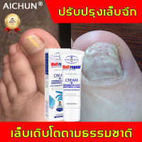 กำจัดเล็บเสียได้เร็ว AICHUN ซ่อมเล็บ 20g บอกลาเชื้อราที่เล็บเท้า เซรั่มทาเล็บ เซรั่มรักษาเล็บ ครีมบำรุงเล็บ เชื้อราเล็บ ซ่อมเล็บที่ชำรุด เอ็สเซ้นซ่อมแซมเล็บเสีย รักษารคเชื้อราที่เล็บ เซรั่มบำรุงเล็บ น้ำมันบำรุงเล็บ ดูแลเล็บครีมบำรุงซ่อมแซมเล็บ