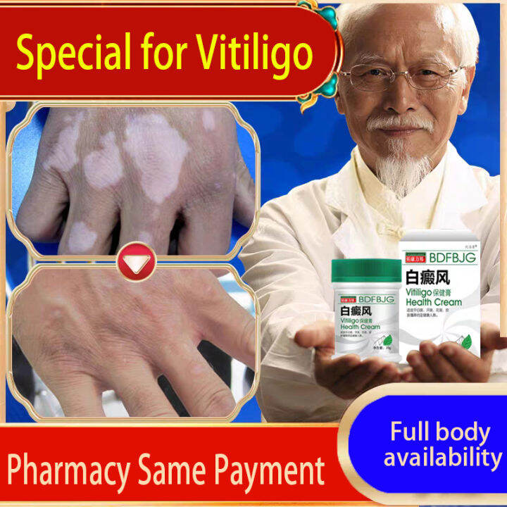 White Spot Cream White Spot Removal Ointment Skin Care Plaster Remove White Spot Cream White Spot Removal Ointment Skin Care Plaster Remove