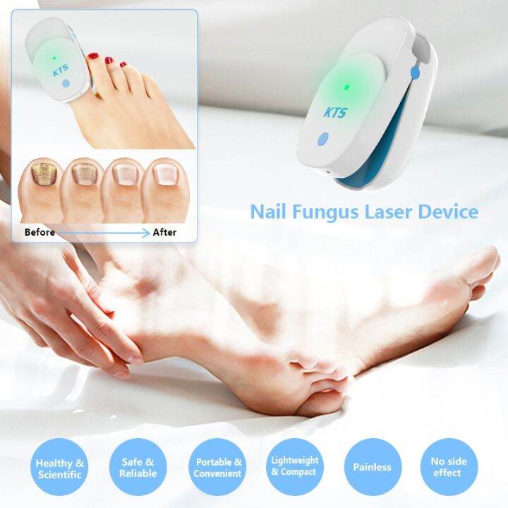 Nail Fungus Laser Treatment 905NM Laser Device 22W Nail Cleaner Therapy Equipment Toe Finger