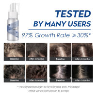 Hair Rapid Growth Essence Spray Fast Hair Grow สำหรับผู้ชายผู้หญิงธรรมชาติอินทรีย์ Anti Hair Loss ช่วยสำหรับการเจริญเติบโตของเส้นผมผม Carehot