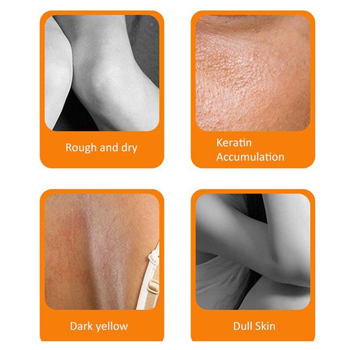 cw-immediate-whitening-peeling-lotion-fnger-knee-armpit-dark-spots-body-brighten-reduce-melanin-even-skin-tone-care-product