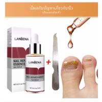 LANBENA เซรั่มบำรุงเล็บ ป้องกันเชื้อรา ซ่อมแซมเล็บแตก เล็บเปราะ เล็บหนาแก้ไขปัญหาเล็บต่างๆ 15ml (พร้อม ตะไบเล็บ)