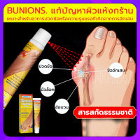 [ความนิยม] เห็นผลไว Bunion cream ลดปวด ลดอักเสบ นิ้วโป้งโค้งงอเข้า Hallux valgus ปวดเท้า ปวดข้อ ปวดบวม ข้ออักเสบ ข้อบวม ข้อต่อนิ้วเท้า บรรเทาอาการ บรรเทาปวด ครีมนวดเท้า ยาแก้ ปวดส้นเท้า （ ยาแก้ปวด แก้ปวดเข่า เจ็บปวดลด ครีมปวดส้นเท้า ปวดข้อเท้า）โปน คด นิ้ว