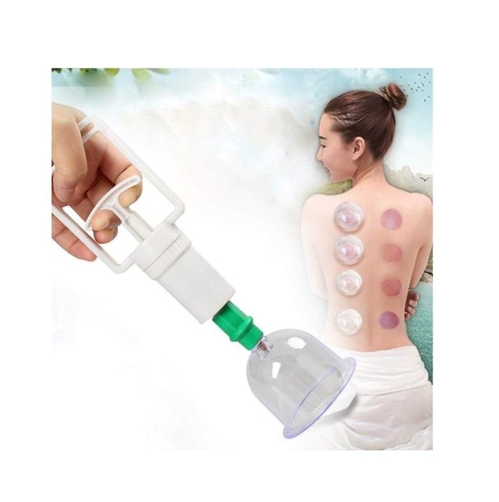 Ventosa Kit Chinese Cupping Therapy | Lazada PH