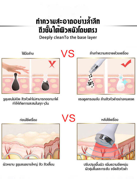 เครื่องฟื้นฟูผิวมัลติฟังก์ชั่น-6-in-1-เลือกใช้ได้ตามที่ต้องการ-เครื่องเติมออกซิเจนให้ใบหน้า-เครื่องเติมออกซิเจนให้แก่ผิว