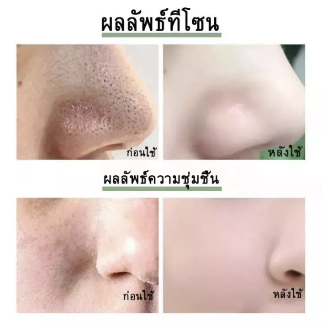 ช่วยเรื่องสิวหน้ากระจ่างใส-ทำความสะอาดล้ำลึก-มาร์คหน้าชาเขียว-มาร์ค-โคลนพอก-ครีมลอกสิวเสี้ยน-พอกหน้า-มาร์คหน้าลดสิว-ที่ลอกสิวเสียน-กำจัดสิวเสี้ยน-โคลนพอกหน้า-มาส์กโคลน-โคลนชาเขียว-มาร์คชาเขียว-ครีมกำจ