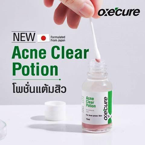 oxe-cure-acne-clear-potion-15ml-อ๊อกซีเคียว-แอคเน่-เคลียร์-โพชั่น-แต้มสิว-สิวอักเสบ-ลดรอยดำ-ไม่ระคายเคือง