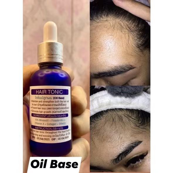 Minoxidil 15 Hair Tonic Oil Basedsealedauthentic Made In Lazada Ph 1908