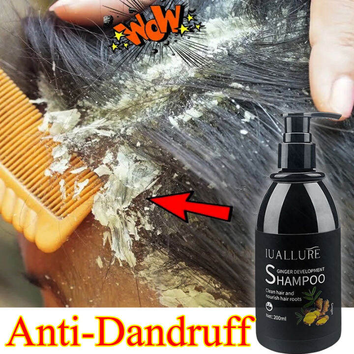 Ginger AntiDandruff Shampoo Ginger Anti Hair Loss and Hair Growth