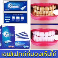 smilekit แผ่นฟอกฟันขาว 7 คู่ 14 ชิ้น/กล่อง ฟอกฟันขาว ขจัดคราบฟัน คราบชา คราบควัน แค่แปะฟันก็ขาวได้ บอกลาฟันเหลือง