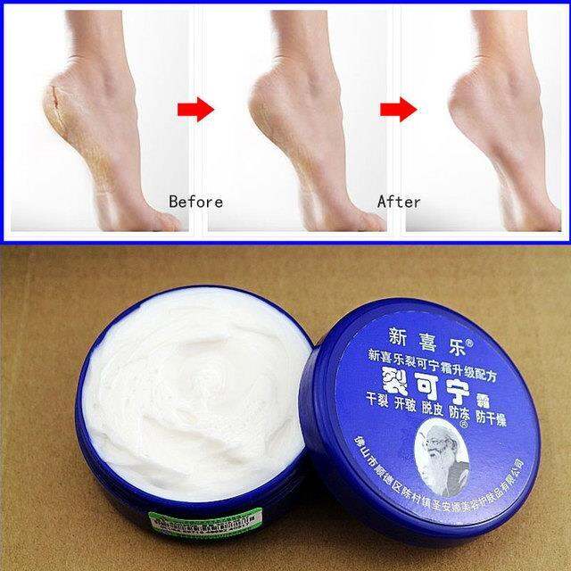 cw-traditional-chinese-33g-oil-anti-drying-crack-foot-cream-heel-cracked-repair-removal-dead-skin-hand-feet-care-mask