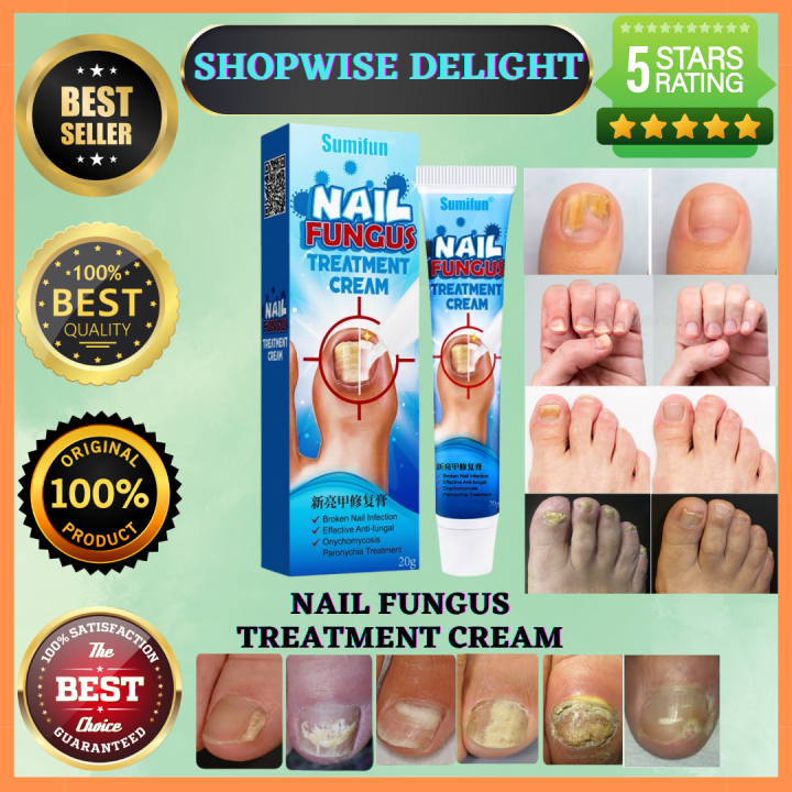 [Doctor Sumifun nail fungus repair treatment Cream 20g