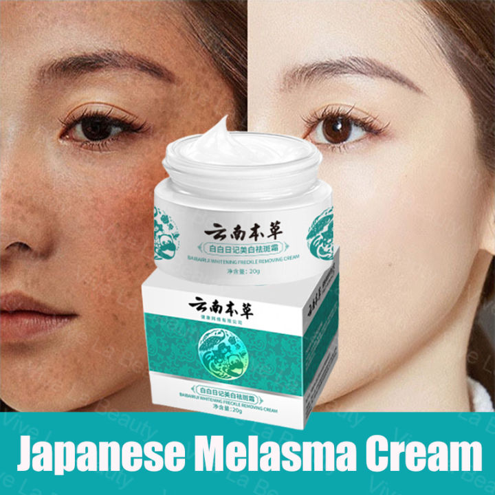 Yunnan Herbal Whitening Freckle Cream Japanese Melasma Cream Melasma Cream Pekas Remover 9291