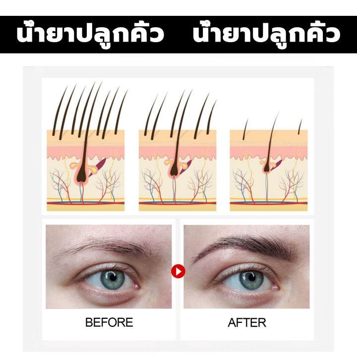 product-details-of-eelhoeเซรั่มปลูกหนวด-30ml-ปลูกคิ้ว-ปลูกคิ้วดกดำ-ปลูกคิ้วของแท้-บำรุงขนตายาว-เซรั่มปลูกคิ้ว-น้ำยาปลูกคิ้ว-น้ำยาเร่งคิ้ว-น้ำยาปลุกคิ้ว-ยาปลูกขนคิ้ว-เชรั่มปลูกคิ้ว-เซรั่มทาคิ้วดก-เซรั่