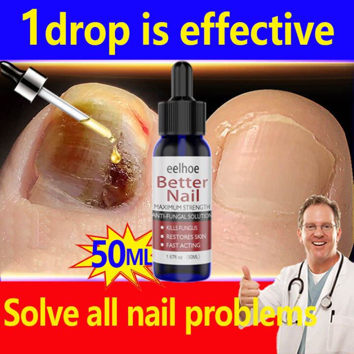 100 Effective nail Fungus Paronychia Nail Repair nail repair treatment