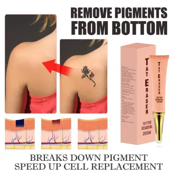 tattoo removal cream smp - Redeem Clinic