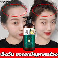 ZHENXIU แชมพูสระผม 300ml แชมพูแก้ผมร่วง ยาสระผมเร่งยาว บำรุงหนังศรีษะและเส้นผม ั มีรังแค หนังศีรษะมัน สำหรับผมเสีย แตกปลาย ชมพูเร่งผมยาว