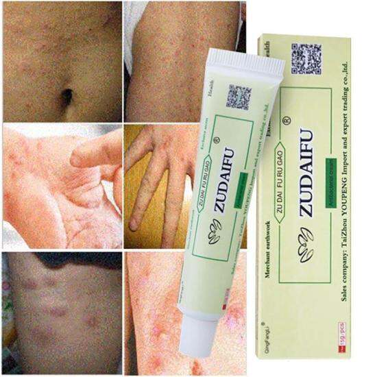 Hcmzudaifu natural chinese herbal medicine cream eczema dermatitis - ảnh sản phẩm 1