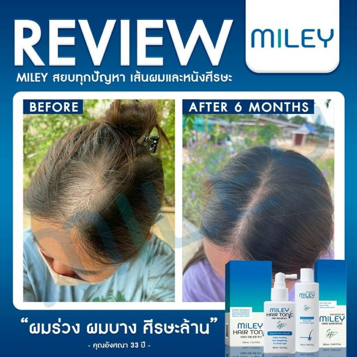 โปรพิเศษ-1-แถม-1-แชมพูลดผมร่วง-มิลเล่-แฮร์-แชมพู-miley-hair-tonic-miley-hair-shampoo-ผลิตภัณฑ์ดูแลเส้นผม-จากเกาหลี