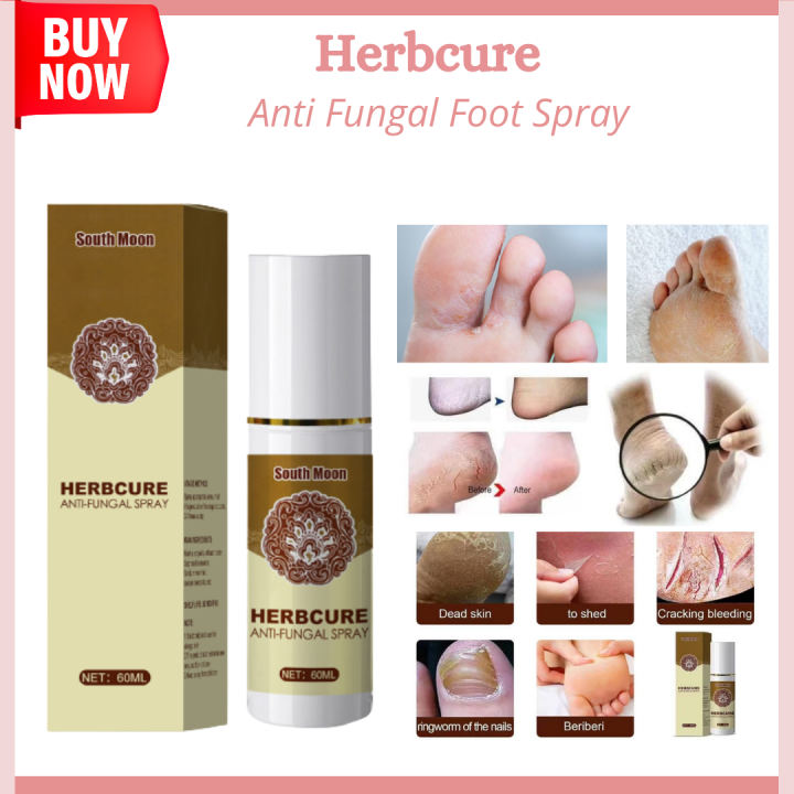 ORIGINAL SOUTHMOON HERBCURE ANTI FUNGAL SPRAY Anti-Fungal Infection ...