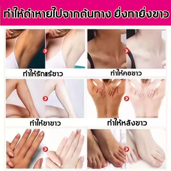 ให้คุณยกแขนขึ้นไม่ต้องอายอีกต่อไป-รักแร้ขาว-ใต้วงแขนดำ-เมลานิน-ปรับปรุงผิว-ไม่มันเยิ้ม-ชุ่มชื้น-ดูแลใต้วงแขน-ครีมทาใต้วงแขนขาว-ครีมหน้าขาวใส-โลชั่นบำรุงผิวกาย-สูตรไวท์เทนนิ่ง-ฟอกผิวกาย-โลชั่นมอยส์เจอไ