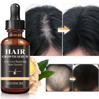 【cw】 Ginger Hair Growth Products Fast Growing Hair Essential Oil Beauty Hair Care Prevent Hair Loss Oil Scalp Treatment For Men Y3K1
