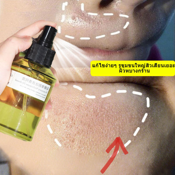 เวอร์บีน่า-pore-essence-สูตรช่วยลดสิว-ช่วยควบคุมความมัน-ช่วยกระชับรูขุมขน-บอกลาปัญหาสิว-ขนาด-เซรั่มบำรุงผิวกระชับรูขุมขน