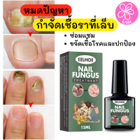 น้ำยาบำรุงเล็บ กำจัดเชื้อราที่เล็บ  Eelhoe nail fungus ฆ่าเชื้อราบนเล็บ เชื้อราที่เล็บ เซรั่มบำรุงเล็บ ขนาด 15 ML