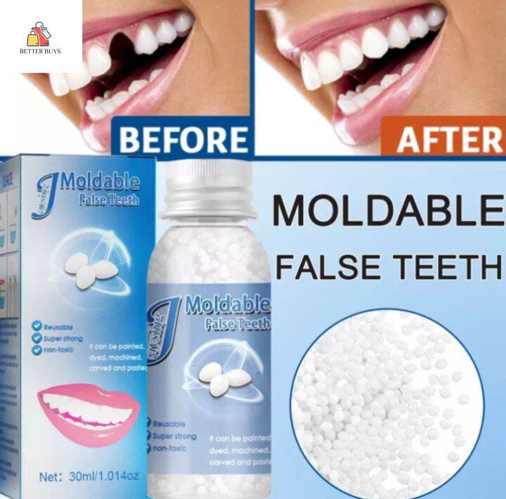 Better Buys Denture Teeth Glue False Teeth 30ML Temporary Tooth Repair