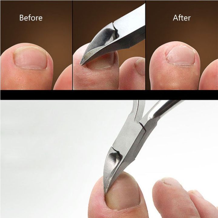 vb-ลด45-กรรไกรตัดเล็บขบ-ทรงโค้งปากนกอินทรีย์-ตัดเล็บขบ-ลึกๆ-กรรไกรตัดหนัง-pedicure-scissors-nail-pedicure-kit-กรรไกรตัดเล็บ-trim-คีมตัดเล็บ-คีมตัดเล็บขบ-ที่ตัดเล็บขบ-ที่ตัดเล็บ-ที่ตัดหนังเล็บ-ที่ตัดหน