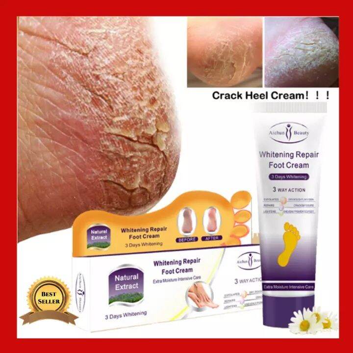 Dry Skin Repair Anti Crack Cream AUTHENTIC Foot Cream for Dry and Rough ...