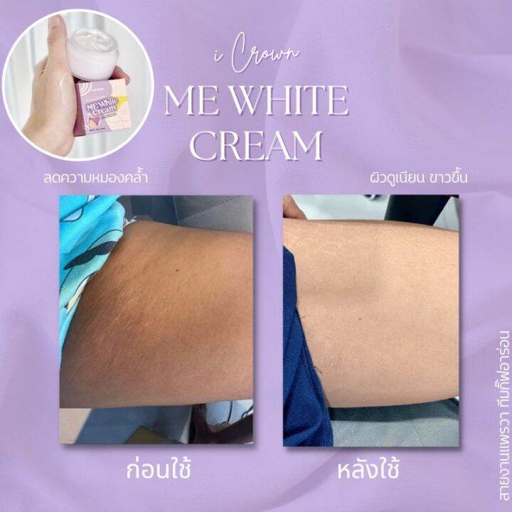 ส่งฟรี-1-ชิ้น-ครีมทาง่ามขาแอนนาme-white-cream