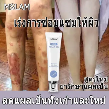 ครีมลดรอยแตกลายแบบเร่งด่วน ราคาถูก ซื้อออนไลน์ที่ - ก.ย. 2023 | Lazada.Co.Th