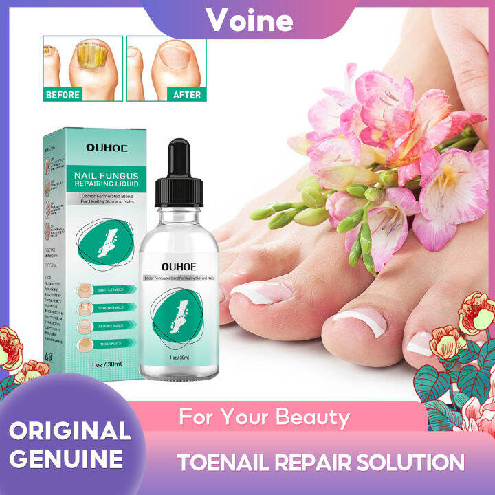 Ouhoe Nail Repair Liquid Hand And Foot Thickening Bright Nail Grey Nail