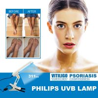 Skin Care Safe 311Nm UVB Phototherapy Medical Light For Small Spot Vitiligo Psoriasis