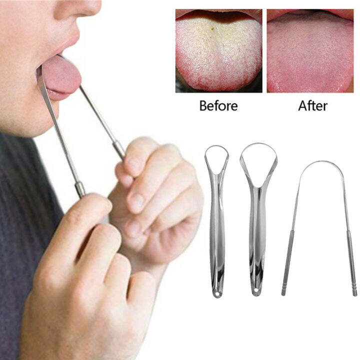 3pcs Stainless Steel Tongue Scrapers Tongue Coating Cleaner Tongue