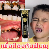 【ซื้อ 1 แถม 1】ลดฟันเหลือง ป้องกันฟันผุ  แผ่นแปะฟันขาว ยาสีฟันน้ำผึ้งธรรมชาติ ? BANGCHILING ลดหินปูน คราบฟัน ปวดฟัน มูสฟอกฟันขาว ยาสีฟันน้ำผึ้ง ยาสีฟันฟอกขา ยาสีฟัน ยาสีฟันขจัดปูน ฟันผุ ยาสีฟันฟันขาว ปวดฟันผุ ฟันขาว น้ำยาขัดฟันขาว ยาสีฟันฟอกฟันขาว