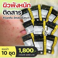 (ของแท้ 100%) แป้งน้ำแต้มสิว CN Unique Acnes Powder ชุดขายดี