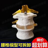 Human spine model can remove the lumbar nerve disc two blind massage medical backbone structure