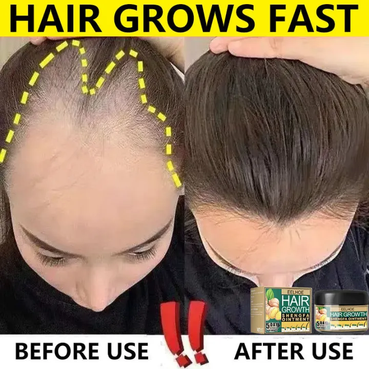 Hair Grower For Men Original Hair Treatment Castor Oil For Hair Growth Hair  Grower Fast Long