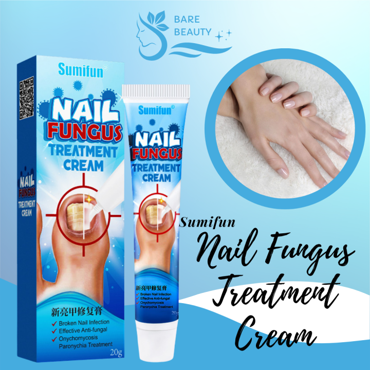 Effective Anti-Fungal | SUMIFUN Nail Fungus Treatment Cream | Nail ...