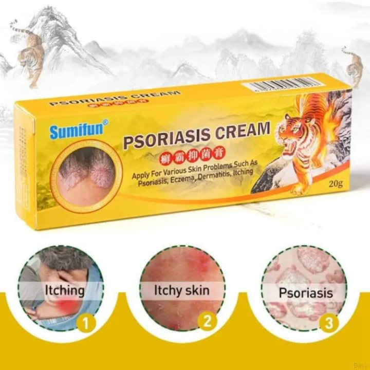 Effective Sumifun Psoriasis Eczema Treatment Cream Antibacterial Cream 20g Quick Anti Itch Used 0882